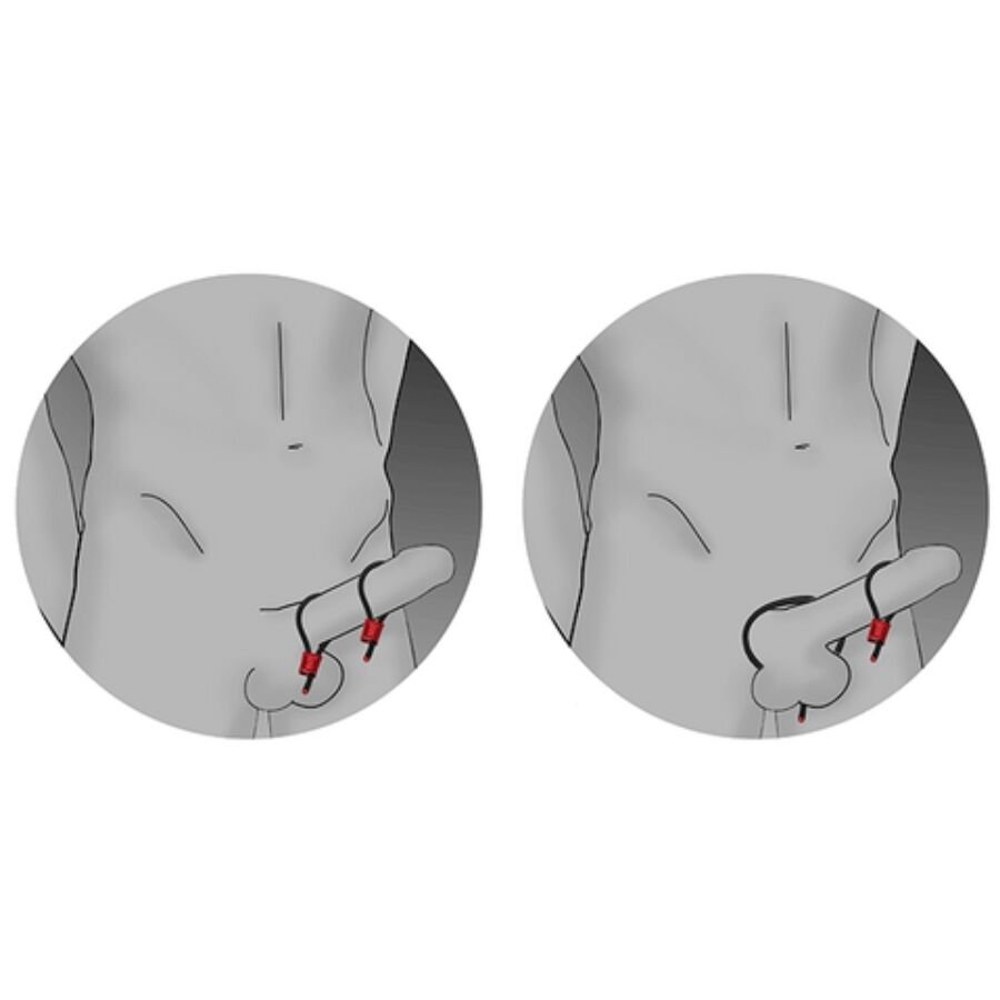 ELECTRASTIM - ANÉIS PENIANOS AJUSTÁVEIS PRESTIGE ELECTRA LOOPS VERMELHOS - Image 3